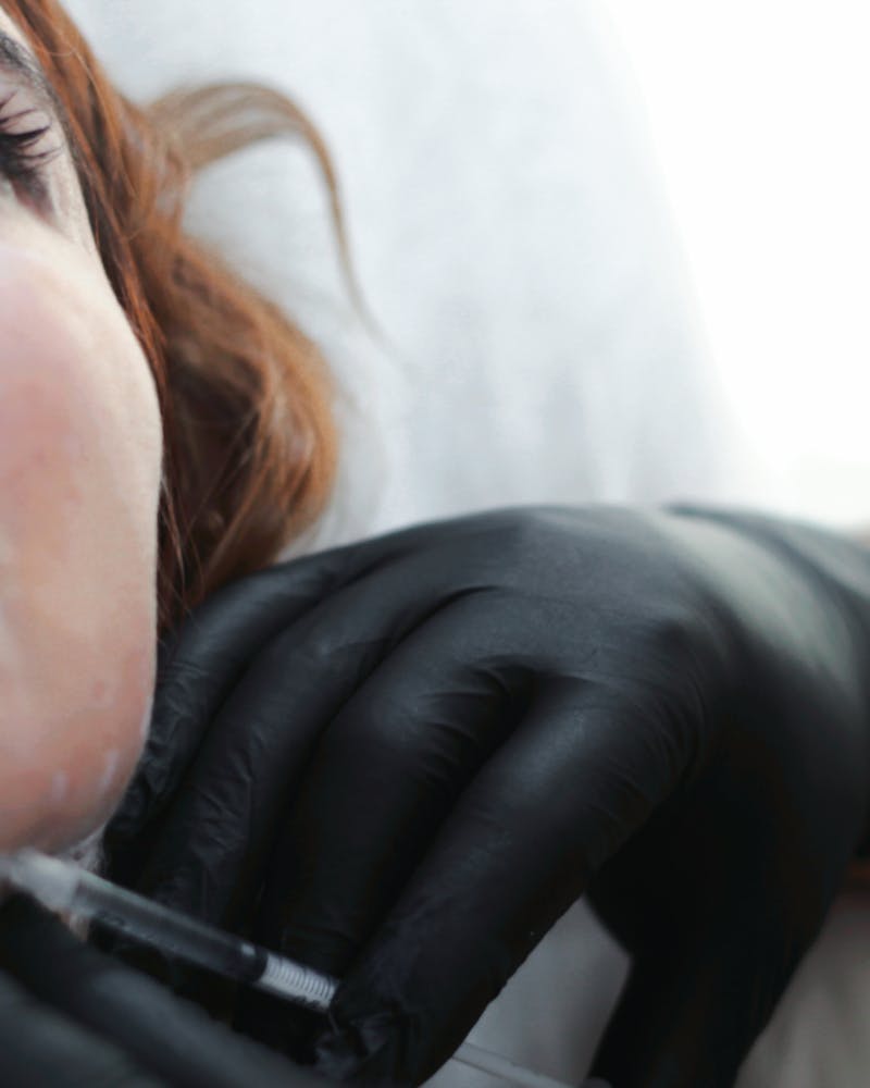 Peau lumineuse et régénérée après traitement aux exosomes visage à Nice