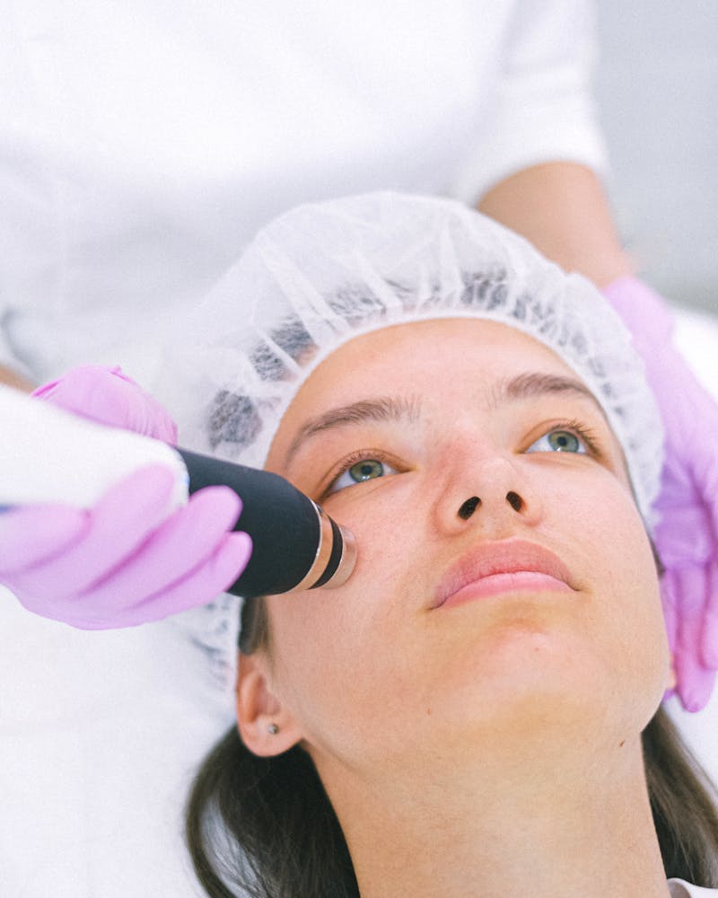 Séance de microneedling Dermapen sur peau lisse en lumière clinique douce à Nice