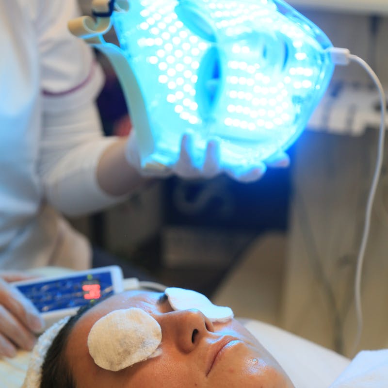 Séance LED thérapie rouge post-microneedling